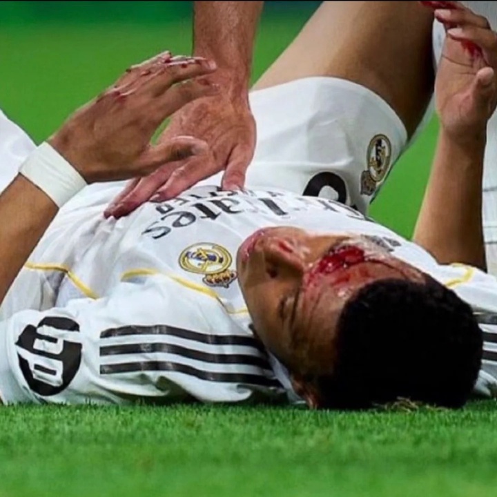 开云体育官网-阿斯报：姆巴佩将首发出战拜仁，他不会佩戴面具